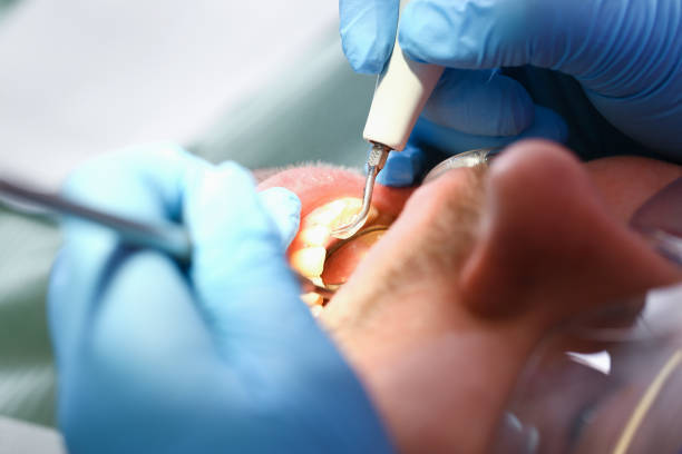 Best Emergency Treatment for Jaw Pain or Injury in Metamora, IL
