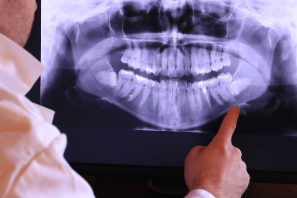 Best Emergency Treatment for Oral Infections in Metamora, IL